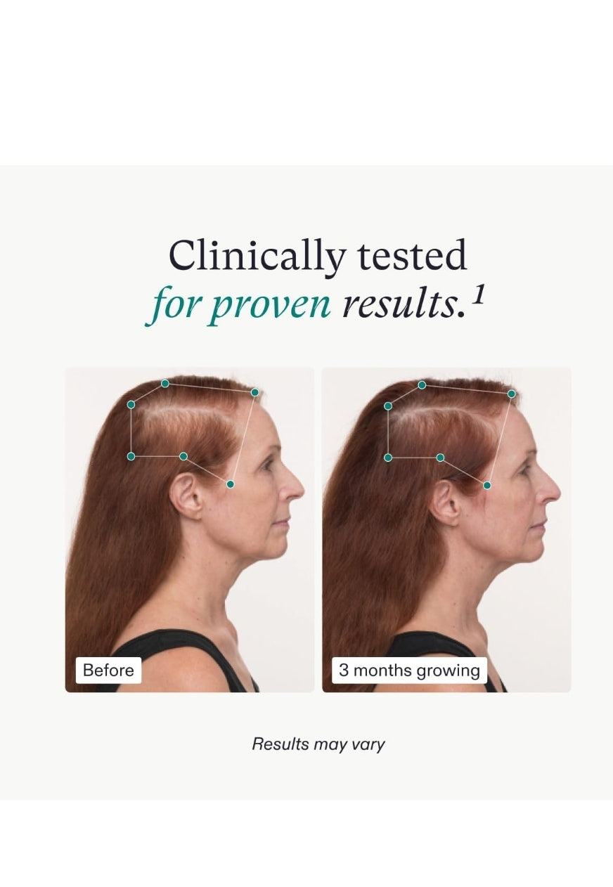 Nutrafol Women's Balance Hair Growth Supplements, Ages 45 and Up, Clinically Proven Hair Supplement for Visibly Thicker Hair and Scalp Coverage, Dermatologist Recommended - 1 Month Supply https://a.co/d/8JDIqYZ